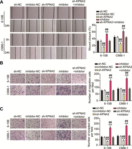 Figure 9 KPNA2 silence reduces NPC cell migration and invasion by regulated miR-3940-3p inhibitor. (A) Wound-healing and migration assays showed that silencing of KPNA2 suppressed migration in 6–10B and C666-1 cells, which was abated by miR-3940-3p knockdown. (B and C) Transwell migration and invasion assay showed that KPNA2 silence inhibited 6–10B and C666-1 cell migration and invasion by regulating miR-3940-3p inhibitor. n = 5 independent experiments. **P<0.001 vs.sh-NC; ΔΔP<0.001 vs inhibitor-NC; ##P<0.001, vs sh-KPNA2+inhibitor.