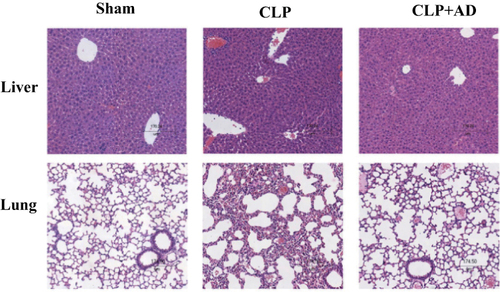 Figure 2 Andrographolide (AD) attenuated the pathological damage of liver and lung tissues in mice with cecal ligation and puncture (CLP)-induced sepsis (n = 5). The liver and lung tissues of the two groups of mice were obtained 48 h after CLP surgery. The pathological sections of each group after hematoxylin and eosin staining were compared under the microscope, and the scale bar was 174.5 μm. Original magnification ×100. Each group had five mice.