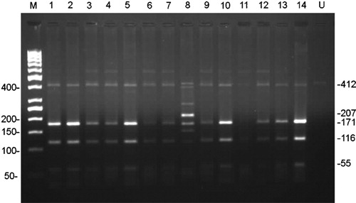 Figure 1. Representation of restriction digest results of 14 samples after PCR on 2% high resolution agarose gel electrophoresis. A distinctive 207 bp band is expected for a mutated sample when digested with DdeI. Lane 8 shows patient sample with T315I mutation. Potential band sizes for both mutated and unmutated samples after digestion can be seen on the right hand side. M: Marker (50 bp DNA ladder), U: uncut control.