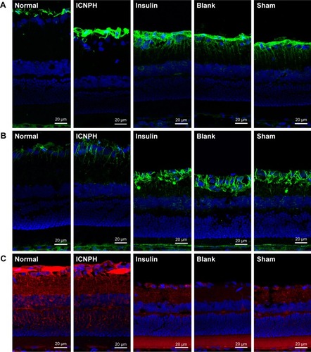 Figure 4 Immunofluorescence staining for GFAP, VEGF, and Occludin expression in retina at 2 weeks after subconjunctival injection.Notes: (A) Immunofluorescence staining showing GFAP expression in retina in different groups. (B) Immunofluorescence staining showing VEGF expression in retina in different groups. (C) Immunofluorescence staining showing Occludin expression in retina in different groups. Normal group: no injection with any drugs; ICNPH group: subconjunctival injection of 20 µL ICNPH containing 80 µg insulin; Insulin group: subconjunctival injection of 80 µg insulin in 20 µL deionized water; Blank group: subconjunctival injection of 20 µL blank nanosized hydrogel; Sham group: an empty syringe without any drugs was punctured into the conjunctiva of the diabetic rats.Abbreviations: GFAP, glial fibrillary acidic protein; ICNPH, insulin-loaded chitosan nanoparticles/PLGA-PEG-PLGA composite hydrogel; PLGA-PEG-PLGA, poly(lactic-co-glycolic acid)-poly(ethylene glycol)-poly(lactic-co-glycolic acid); VEGF, vascular endothelial growth factor.
