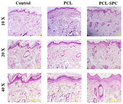 Figure 8 Representative images of H&E stained healed skin sections harvested 27 days post-wounding. It can be observed that PCL-SPC treatment was promising in improving the architecture of the epidermis and dermis compared to both sham and PCL control groups.