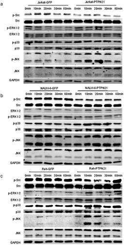 Figure 4. Overexpression of PTPN21 activated Src and the MAPK signaling pathways in EGF-stimulated ALL cells. (a) Western blot data show that in Jurkat cells, PTPN21 overexpression reduced p-Src level and upregulated p-ERK1/2 and p-JNK levels, but had no impact on p-p38 level. (b) Western blot data reveal that in NALM-6 cells, PTPN21 overexpression led to a decreased level of p-Src and elevated levels of p-ERK1/2 and p-p38 but didn’t affect p-p38 level. (c) Western blot results uncover that in Reh cells, excessive PTPN21 downregulated p-Src level and elevated levels of p-ERK1/2, p-p38, and p-p38.