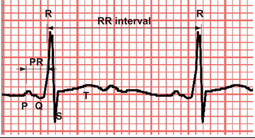 Figure 1. ECG SIGNAL – A TYPICAL P-QRS-T COMPLEX.