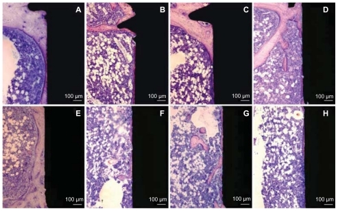 Figure 8 Histological non-decalcified ground sections of bone interface of 60 nm (A and E), 120 nm (B and F), 220 nm (C and G) nanopatterned surfaces and reference (D and H) non-patterned surface after 28 days of implantation. Upper images (A–D) represent the histological section in the endosteal compartment (Part A). This compartment is dominated by the downgrowth of mineralized endosteal bone in direct contact with the implant surfaces. Lower images (E–H) show histological sections in the bone marrow compartment (Part B). Mineralized bone growth along the implant in the medullary area is also observed in direct contact with the 60 nm patterned implant surface.