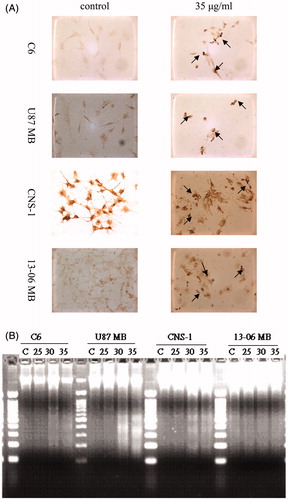 Figure 5. Apoptosis induced by prenylated chalcone treatment in glioma cells. (A) Chromatin condensation caused by 35 μg/ml prenylated chalcone at 24 h. (B) DNA fragmentation caused by 25, 30 and 35 μg/ml prenylated chalcone at 48 h. Marker: a 100-bp DNA ladder (left lane).
