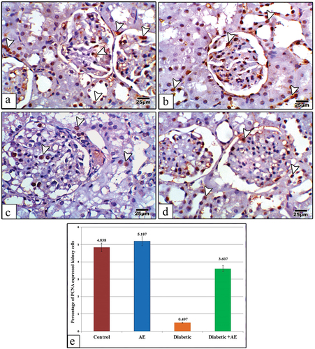 Figure 6. Images of kidney sections from control (a), AE (b), STZ (c), and STZ+AE (d) stained with PCNA antibody. The immunohistochemical expression of PCNA appears strong in the glomerular and tubular cells of the control and AE groups, very weak in the diabetic group, and moderately expressed in the diabetic and AE groups. Panel (e) indicates the quantitative analysis (using image analysis) for the percentage of PCNA expressed kidney cells among investigated groups. The arrowheads point to PCNA immunoreactivity. (PCNA antibody stain, scale bar: 25µm).