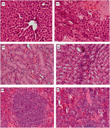 Figure 5. The histopathological examination of H and E stained liver of mice exposed to (a) control (b) high dose NPs via the IV route with damage most evident by steatosis, vacuolar degeneration, inflammatory cell influx and hepatic necrosis; kidneys of mice exposed to (c) control (d) high-dose NPs via the IV route with small influx of immune cells and from spleen of mice exposed to (e) control (f) IV exposed to high-dose NPs resulting in observation in a number of giant macrophages.