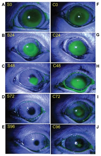 Figure 5 Fluorescein staining micrograph of a representative corneal wound obtained at 0, 24, 48, 72, and 96 h after wounding. The left column (A–E) represents corneas treated with mSC suspension (200 μg/mL), and the right column (F–J) represents corneas treated with phosphate-buffered saline.Abbreviation: mSC, micronized sacchachitin.