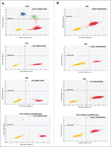Figure 2. Representative 2D intensity scatter plot of wild-type and mutant amplicon for KRASG12D (A) KRASG12D and (B) TP53R273H, PDAC patients (P16, P50), an IPMN patient (P30) and a CP patient (P66), and control spiked-in reactions (0.5% mutant). Threshold for mutant was set to 8800. Yellow, no DNA; blue, mutant; red, wild-type; green, mutant and wild-type, ng: nanograms.