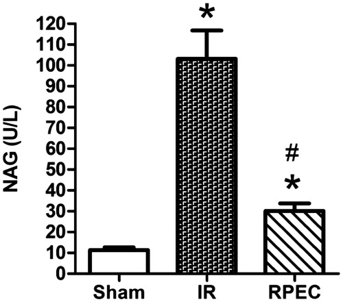 Figure 1. Effects of RPEC on urinary NAG activity. I/R, ischemia/reperfusion group; RPEC, remote perconditioning group; each column and bar represents the mean ± SEM (n = 6 in each group). *p<0.05 compared with the sham group; #p<0.05 compared with the I/R.