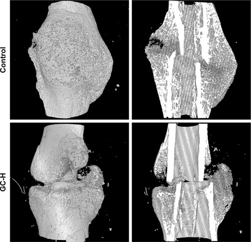 Figure 4 Micro-CT images of fractured femoral callus from representative specimens at 2 weeks post-fracture.