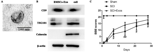 Figure 1 Morphology of BMSCs-Exo as assessed by transmission electron microscopy and BBB scores.