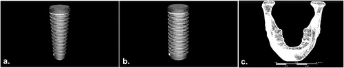 Figure 3. Models of dental implants and mandible used in FEA: conical implant (a); cylindrical implant (b); mandible (c).