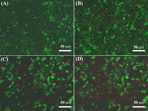 Figure 7. The AO/EB double staining fluorescence images of MCF-7 cells treated with blank control (A), Fe3O4@mSiO2-NH2-FA-TAX nanocomposites without MF (B), free TAX (C), and Fe3O4@mSiO2-NH2-FA-TAX nanocomposites with MF (D) for 24 h.