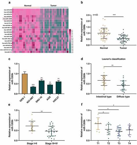 Figure 1. The expression of miR-1269b is inhibited in GC tissues and cells(a) Expression levels of miRNAs in GC tissues (Tumor) and adjacent normal tissues (Normal) in GSE93415. (b) The expression of miR-1269b in GC tissues and adjacent tissues was detected by qRT-PCR. (c) The expression of miR-1269b in GC cells and GES-1 cells was detected by qRT-PCR. (d) Difference in the expression level of miR-1269b between intestinal type GC tissues and diffuse type GC tissues. (e and f) The expression of miR-1269b in GC tissues with different clinical stage (e) and T stage (f). *P < 0.05, **P < 0.01, and ***P < 0.001