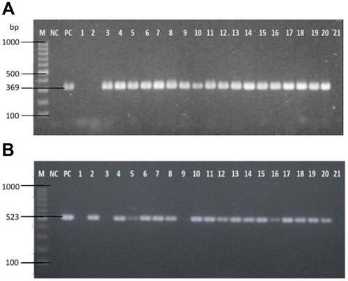 Figure 2 (A) Representative image of the amplified PCR products of HLGR gene, aac(6’)-Ie aph(2”)-Ia of Enterococcus isolates (expected size: 369 bp). (B) Representative image of the amplified PCR products of HLSR gene, aph(3’)-IIIa of Enterococcus isolates (expected size: 523 bp).Abbreviations: Lane M, 100 bp ladder; NC, negative control (DNA-free template); PC, positive control (ATCC strain 51299); Lanes 1–21, Enterococcus isolates.