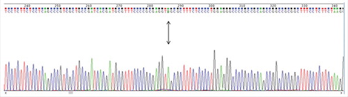 Figure 1. Electropherogram of DNA sequence obtained from peripheral blood of a Brazilian asymptomatic individual. The point mutation (G245A) that resulted in the premature stop codon is highlighted and indicated with an arrow. It is localized at position 286 in the present electropherogram.