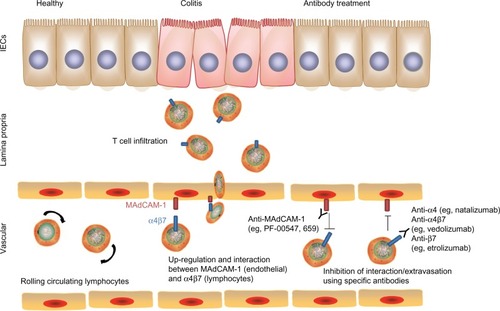 Figure 5 Blocking of immune cell trafficking to the colon. Upregulation of mucosal addressin cell adhesion molecule-1 (MAdCAM-1) on intestinal vascular cells and expression of integrins (eg, α4β7) on lymphocytes promote interaction and adhesion of lymphocytes onto the intestinal endothelium and subsequent extravasation into colonic tissues. Blocking MAdCAM-1 or α4β7 using specific antibodies disrupts this interaction and control of colitis severity.