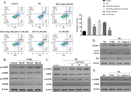 Figure 8 Effect of G-Rg1 combined with AMPK inhibitor on cell apoptosis in HG-induced RIN-m5F cells. (A) RIN-m5F cells were treated with 100 μM of G-Rg1 with or without AMPK inhibitor (Compound C, CC, 50 nM) for 24h and followed by incubation with HG for 48h. The apoptosis rate of HG-induced RIN-m5F cells was evaluated by flow cytometry. (B) The expression levels of p-AMPK, AMPK, p-mTOR and mTOR of RIN-m5F cells with conventional culture conditions were assessed by Western blotting. (C) The expression levels of p-AMPK, AMPK, p-mTOR and mTOR of HG-induced RIN-m5F cells under G-Rg1 treatment were assessed by Western blotting. (D and E) The expression levels of Beclin-1, LC3, P62, p-AMPK, and AMPK were measured with Western blot analysis in the G-Rg1 combined with CC-treated RIN-m5F cells. *P<0.05, **P<0.01, compared with the HG group. #P<0.05, ##P<0.01, compared with the HG+G-Rg1 (100 μM) group. &&P<0.01, compared with the HG+CC (50 mM) group.