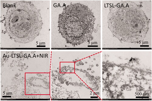 Figure 9. TEM images of MCF-7 cells treated with Au-LTSL-GA.A were analyzed at a concentration of 30 µg/mL measured for 5 min upon irradiation (0.25 W/cm2). Red squares and red arrows indicate Au-LTSL-GA.A. Assay treated with PBS is the blank. The GA.A (30 µg/mL) and LTSL-GA.A (30 µg/mL) were set as the control group.