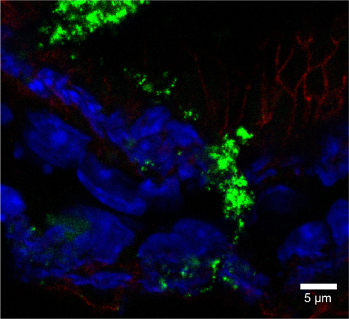 Figure S7 Rhodamine 6G/silica particles in small intestine tissue.Notes: Mice were administered optimized Rhodamine 6G/silica particles orally every 24 hours for 4 days, and organs were harvested 3 hours after the final administration. Confocal microscopy of frozen small intestine tissue section is shown. Section was stained with 4′,6′-diamidino-2-phenylindole (cell nuclei; blue) and E-cadherin (junctions between epithelial cells; red). Rhodamine 6G/silica particles are green.