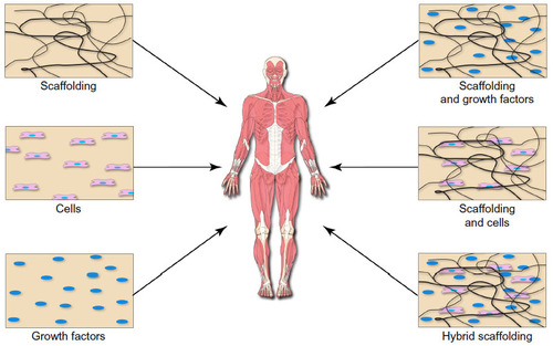 Figure 2 Tissue engineering and regenerative medicine rely on the implementation of various cell-, biomolecule-, and scaffold-based approaches to restore structure and function to developing and/or damaged tissues.