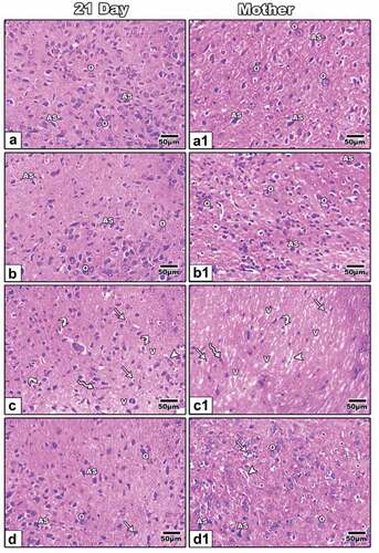 Figure 4. Photomicrographs cross-histological sections of the optic nerve of 21-day-old offspring (a-d) and mother (a1-d1) rats; Control (a&a1) and ZnO NP-treated group (b&b1) showing normal oligodendrocytes and normal astrocyte; 21-day old offspring rats and their mothers treated with LPS showing cytoplasmic vacuolated cells, pyknotic cells, degenerated oligodendrocytes, dilated blood vessels and vacuoles (c&c1); 21-day-old offspring and their mother rats treated with LPS and ZnO NPs showing structural improvement (d&d1). H&E. Abbreviations: AS indicating astrocyte, O indicating oligodendrocyte, V-vacuole; Arrow indicating pyknotic cells; Arrowhead indicating dilated blood vessels; Curved arrow indicating degenerated oligodendrocytes; Zigzag arrow indicating cells with cytoplasmic vacuolation.