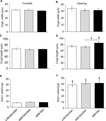 Figure 4 Comparison of crypt dimensions and number of EdU-positive cells measured with cryostat and clearing techniques.