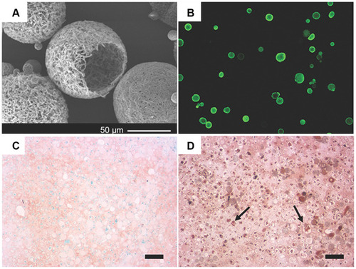 Figure 2 TGF-β1 mimicking peptide with surface modified nanofibrous PLLA microspheres induced stem cell chondrogenesis. (A) SEM images of surface modified nanofibrous microspheres. (B) A cross-sectional confocal image of FNF-HMS after fluorescent tagging of the conjugation sites. (C) Positive safranin-O staining for GAG in CM10-FNF-HMS/BMSCs group after 2 weeks subcutaneous implantation. (D) Positive immunohistochemical staining for collagen type II in CM0-FNF-HMS/BMSCs group after 2 weeks subcutaneous implantation. Scale bar: 100 µm.Notes: Reprinted from Zhang Z, Gupte MJ, Jin X, Ma PX. Injectable Peptide Decorated Functional Nanofibrous Hollow Microspheres to Direct Stem Cell Differentiation and Tissue Regeneration. Adv Funct Mater. 2015;25(3):350–360. Copyright 2015 with permission from John Wiley and Sons.Citation84