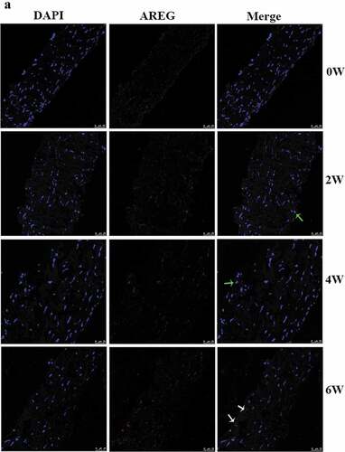 Figure 2. Immunofluorescence and semi-quantification analysis of AREG expression in posterior sclera. Photographs of AREG protein expression in control group (a) and in FDM group (b) at each time point were shown. Blue staining is DAPI and red staining is AREG (scale bar: 25 μm). AREG was mainly located in the cytoplasm (white arrow) and nuclear (green arrow) of the fibroblasts, including the cytomembrane and nuclear membrane. (c) shows the average gray value of AREG expression at different time points in the two group. The data was expressed as mean±standard error. AREG protein expression in FDM group was upregulated in 2 W and 4 W and slightly downregulated after 2 weeks of recovery (6 W) (all p < .05), while no significant difference was found in AREG expression at the different time points in the control groups (all p > .05). AREG expression was higher in the FDM group than in the control group in 2 w, 4 w, and 6 W (all p < .05) but not in 0 W (p = .607). ***p < .001, comparison between the two groups; ##p < .01 and ###p < .001 compared with the control group at the same time-point