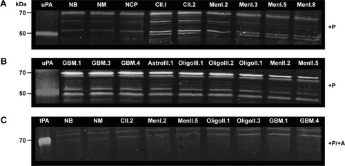 Figure 4 uPA activity in normal canine brain tissues and brain tumors as determined with casein–plasminogen zymography.