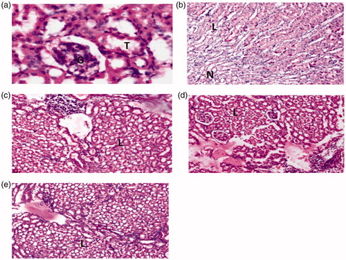 Figure 3. Histopathological analysis of the kidneys of Sprague–Dawley rats at the 8th day of treatment after gentamicin-induced nephrotoxicity. (a) Normal control group showing normal appearance of glomeruli (G) and tubules (T). (b) Toxic control group exhibiting focal necrosis (N) and lymphatics infilterate (L). (c) 200 mg/kg AMECR group presenting moderate lymphatic infilterate (L). (d) 400 mg/kg AMECR group displaying mild lymphatic infilterate (L). (e) 600 mg/kg AMECR group revealing minute lymphatic infilterate (L).