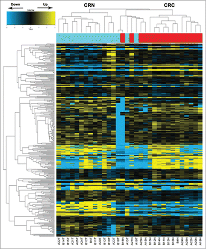 Figure 1. MicroRNA array analysis of miRNA expression in colorectal tissues. Hierarchical clustering of the expression values for mature miRNAs of CRN versus CRC tissues. Yellow indicates high relative expression, and blue indicates low relative expression. CRC: colorectal cancer tissues; CRN: matched adjacent noncancerous colorectal tissues.