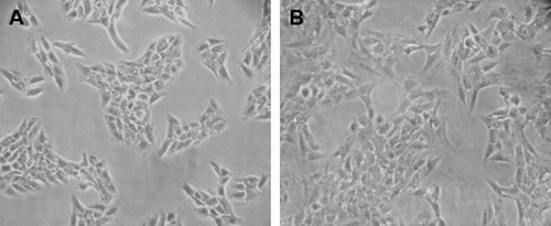 Figure 1. HSC-T6 cell cultures. HSC-T6 cells were cultured with RMPI 1640 medium for 24 h (A) and 48 h (B) (×200).