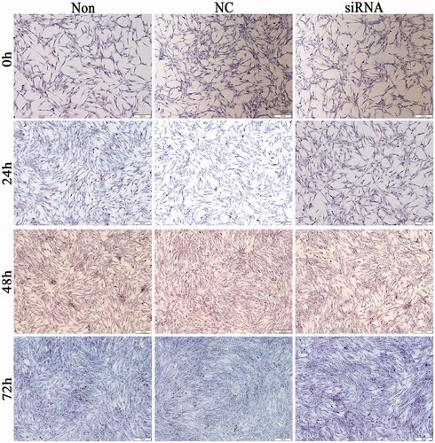 Figure 6. Morphology and lipid aggregation of chicken adipocytes after HSP90-siRNA (10×) transfection. siRNA, NC, and Non represent the HSP90-siRNA (siRNA), negative control (NC), and non-transfected (Non) groups, respectively.