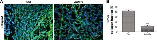 Figure 2 AuNPs decreased stromal collagen I level in SW620 tumor. (A) Immunofluorescence images of the effect of AuNPs on stromal collagen I (green) level in SW620 tumor. Scale bar, 100 µm. (B) Quantification of tumor collagen I level after the administration of AuNPs. AuNPs reduced the proportion of collagen I-positive region in SW620 tumor (n=6, ***P<0.001, Student’s t-test).Note: Error bars indicate SEM.Abbreviations: AuNPs, gold nanoparticles; Ctrl, control; SEM, standard error of the mean.