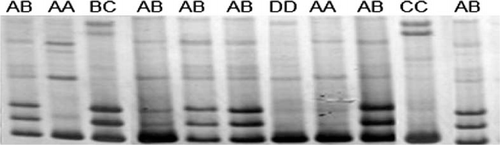 Figure 2.  PCR-SSCP analysis on second intron of goose PRL gene.