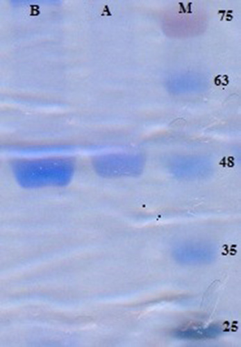 Figure 1 SDS-PAGE analysis of purified recombinant protein of α-toxin by Ni-NTA resin M: prestained Protein Ladder (Sinaclon, Iran) (10–170 kDa), Cat No. SL7011 (PR911654); Lanes A and B indicate second and fourth eluted fraction of recombinant protein of E. coli BL21 (DE3) transformed with pET28a/-α- toxin-6×His tags.