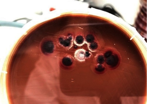 Figure 1 Fungal blood culture demonstrating white to tan-colored, velvety and flat colonies with red soluble pigment.