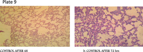 Figure 7. Plate 9: Control: Alveoli are clear and devoid of exudates. There is no congestion (Mg: 100×). (Concentration 1 = 2.3 × 107 Concentration 2 = 3.2 × 105).