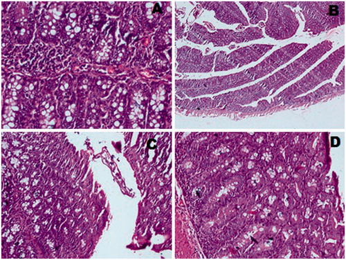 Figure 6. Photomicrographs of sections of colons of mice (A) Normal mice colon (intact epithelium structure) (B) control group (severe necrosis) (C) CUR-treated group (reduced necrosis up to moderate extent) (D) CUR microsphere-treated group (negligible sign of necrosis).