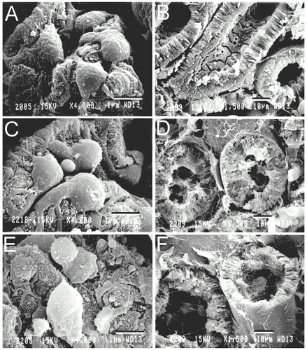 Figure 5. Scanning electron micrographs of podocytes and cortical tubules. Kidneys were prepared for SEM, as described in MATERIALS AND METHODS. A and B are normal kidneys. C and D are kidneys after 90 min of warm ischemia. E and F are kidneys after 48 h of cold storage in UW solution. A, C and E show glomerular podocytes. B, D and F show proximal tubules. In C, note swelling of podocytes, as compared to normal kidney (A). In E, podocyte alterations after cold ischemia were more marked than after cold ischemia (C). Note large blebs protruding from podocyte cell bodies and the swelling and disorganization of foot processes (pedicels). In D, note swollen tubular walls and debris accumulation in tubular lumens, as compared to normal kidney (B). After 48 h of cold ischemia, tubular walls became thinner with blebbing and partial loss of brush borders on the apical surface (F). Bars are 5 µm for A, C and E and 10 µm for B, D and E.
