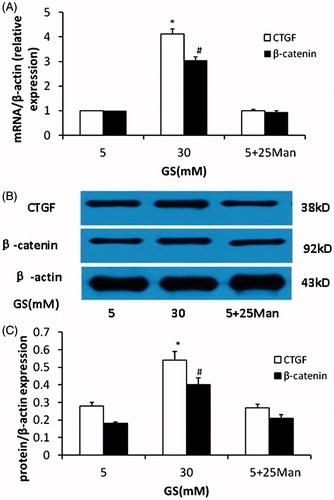 Figure 2. Effects of high glucose on CTGF and β-catenin expression in podocyte. (A) High glucose induced overexpression of CTGF and β-catenin mRNA in podocytes compared to normal glucose. (B and C) Western blot analyses showed the upregulation of CTGF and activation of nuclear β-catenin in podocytes in high-glucose condition. The osmotic pressure have no effects on CTGF and β-catenin expression (GS, glucose; Man, mannitol; mM:mmol/L, *p < 0.05 vs. 5 mM GS, #p < 0.05 vs. 5 mM GS, n = 3).
