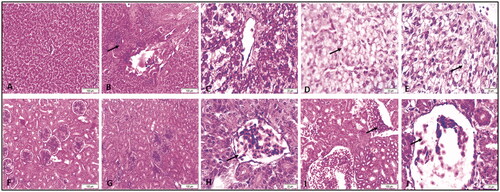 Figure 3. Representative micrographs for liver (A–E) and kidney (F-J) of broiler chickens treated with different levels AgNPs for 42 days, H&E stain. A) Liver from control group showing normal hepatic architecture. (B) Liver from 2.5 mg group showing focal mononuclear infiltration (arrow). (C) Liver from 5 mg group showing congestion and vacuolar degeneration. (D) Liver from 10 mg group showing hepatocellular vacuolation (arrow). (E) Liver from 20 mg group showing hepatocellular vacuolation (arrow). F) Kidney from control group showing normal glomerulus and renal tubules. (G) Kidney from 2.5 mg group showing normal glomerulus and renal tubules. (H) Kidney from 5 mg group showing congestion of the glomerulus (arrow). (I) Kidney from 10 mg group showing severe congestion of the blood vessels (arrow). (J) Kidney from 20 mg group showing congestion of the glomerulus (arrow).