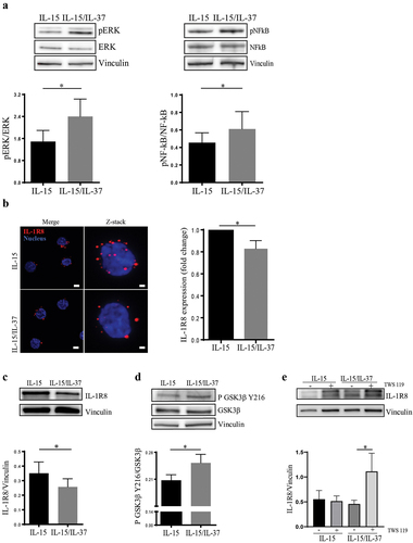 Figure 2. Effects of IL-37 on IL-1R8 expression and GSK3β phosphorylation.