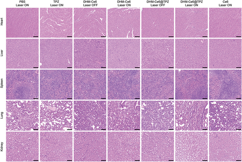 Figure 7 Histological analysis of major healthy organs (heart, liver, spleen, lung, and kidney) at the end of efficacy study (scale bar: 100 µm).