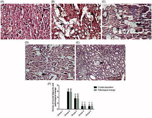 Figure 3. Histopathology (100×) of crystalline formation in the renal sections of rats with H&E staining for groups 1–5 (A–E) and scores for the crystal deposition and histopathological changes (F). Black arrows indicate renal crystals and white arrows indicate inflammatory cell invasion. Values are expressed as the mean ± standard error.(n = 10). a p <.05 versus group 1; b p <.05 versus group 2; c p < .05 versus group 3 and d p < .05 versus group 4.
