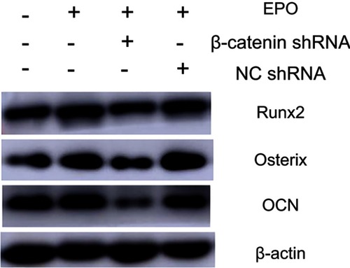 Figure 6 Effect of Erythropoietin (EPO) on protein expression of Osterix, Runx2 and OCN in Periodontal ligament stem cells (PDLSCs) under different treatment (Osteogenic induction group, EPO group, EPO+NCshRNA group and EPO+β-catenin shRNA group).