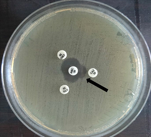 Figure 1 Double-disc synergy test 1. Positive test: Enhancement of zone of inhibition from amoxicillin–clavulanic acid towards ceftazidime disc and ceftriaxone disc (black arrow).