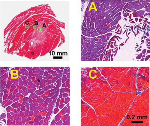 Figure 2. Typical Masson trichrome-stained histology images show a zonal response. The image of the entire histology slide (top left) was formed by tiling a series of pictures as described in the Materials and methods section. Magnified (100 × ) histology images (zones A, B and C) show characteristics following RF ablation in rabbit thigh muscle. The labeled boxes in the entire histology image show the location of the magnified histology images. A distinct thermal lesion can be seen as an elliptical region stained light purple. In the central zone of the lesion (zone A), the RF needle track is seen as an empty cavity. The figure is reproduced in colour in the online issue of Computer Aided Surgery.